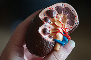 A hand holds a model of a kidney.