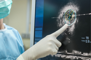 A physician wears PPE in the surgical suite and points to an IVUS/OCT image on a computer screen.