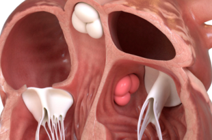 An illustration of a cross section of the heart showing the valves.